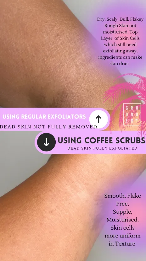 Dry Skin Buster Coconut Body Scrub