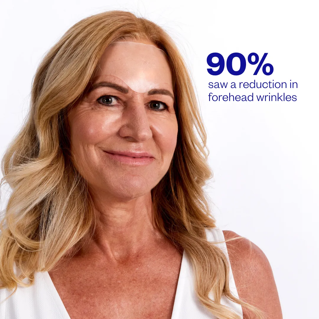 Forehead Wrinkle Patches - 2 Patches