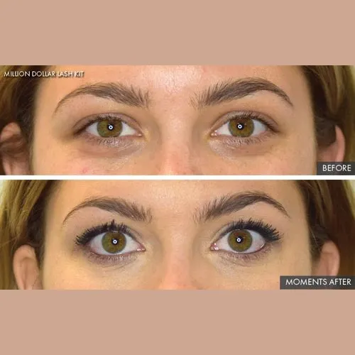 Million Dollar Lash Kit