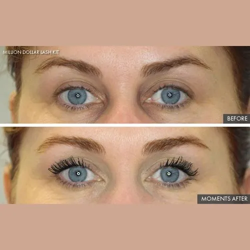 Million Dollar Lash Kit